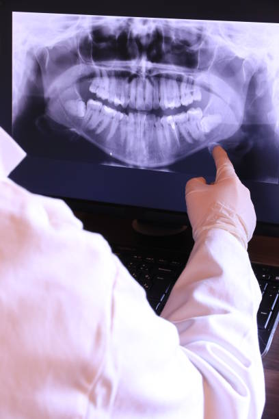 Best Emergency Root Canal Treatment in Allentown, PA